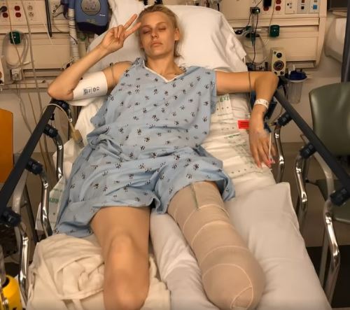 Woman Loses Her Legs Due To Common Household Product, Now She’s Warning Women Everywhere