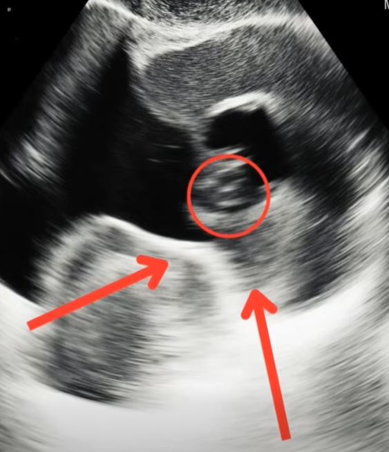 For a month, constant stomach pain drained me. When I finally saw a doctor, his unexpected diagnosis left me speechless, shaken, and forced me to reconsider everything about my health.